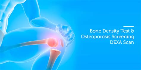 Comprehensive Guide to Bone Densitometry (DEXA) - Uses, Procedure, and ...