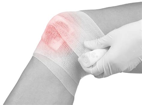 Cotton Bandage Over a Wound on Knee. Stock Image - Image of skin ...