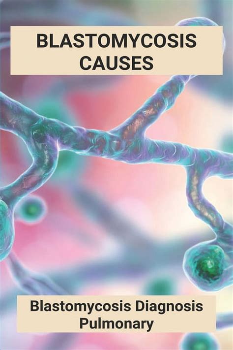 Blastomycosis Causes: Blastomycosis Diagnosis Pulmonary: Cutaneous ...