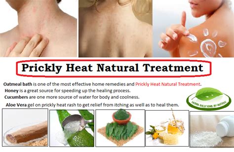 Heat rash treatment adults antibiotics