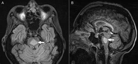 Southwest Journal of Pulmonary, Critical Care and Sleep - Imaging ...