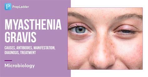 Myasthenia Gravis: Causes, Antibodies, Manifestation, Diagnosis, Treatment