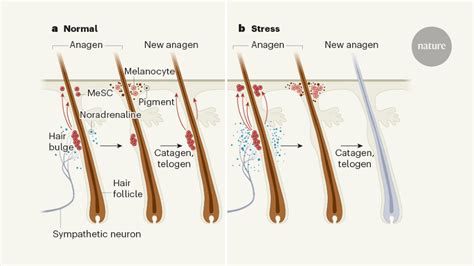 What Causes White Hair In Humans - White Hair Causes How To Stop White ...