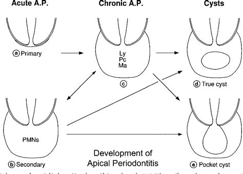 Figure 4 from Pathogenesis of apical periodontitis and the causes of ...