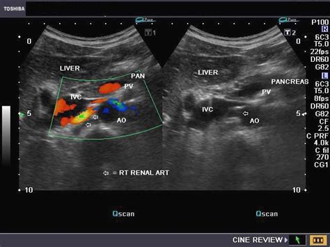 Ultrasound image gallery | Ultrasound school, Diagnostic medical ...