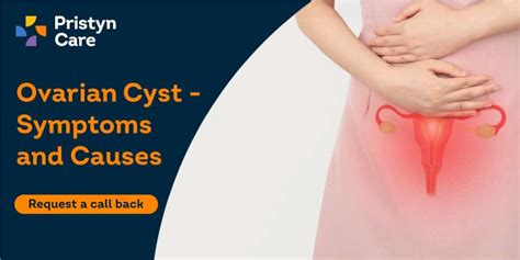 Ovarian Cyst: Causes, Symptoms And Treatment