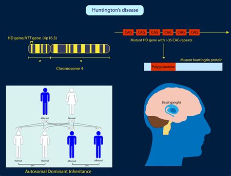 Huntington disease: MedlinePlus Genetics