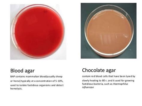 Chocolate Agar media - Preparation and Uses - Laboratoryinfo.com