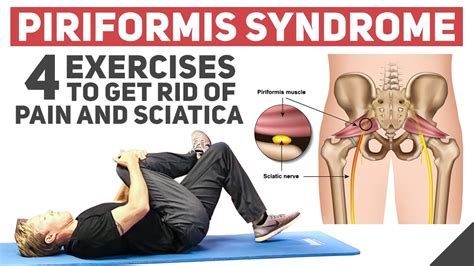 Piriformis Exercises