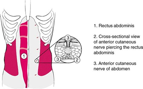 Abdominal Cutaneous Nerve Entrapment Syndrome (ACNES): A Not-So-Rare ...