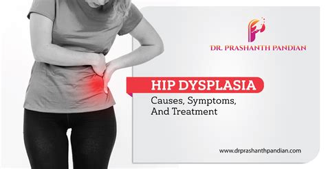 Hip Dysplasia: Causes, Symptoms, And Treatment - Dr. Prashanth Pandian