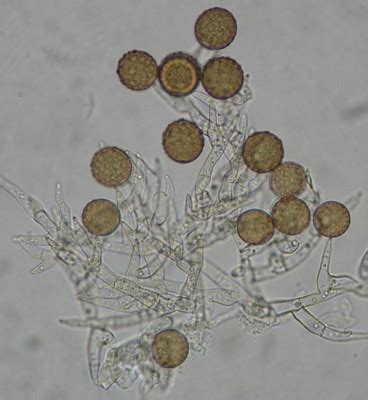 Gallery For > Fungi Mold Under Microscope