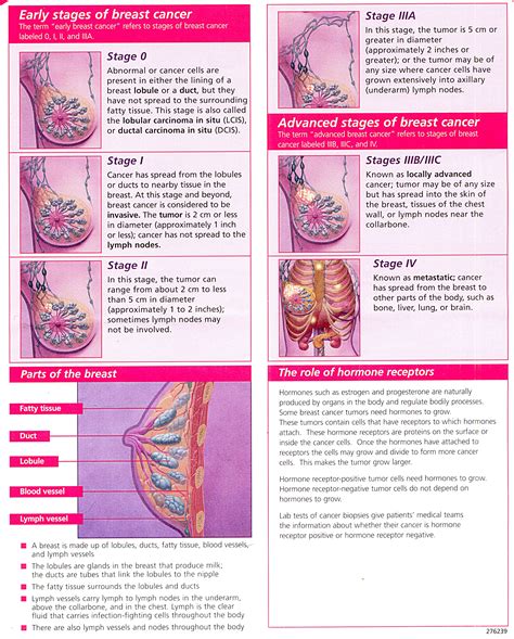 Visual Guide to The Stages of Breast Cancer – Rocking The Road for A Cure