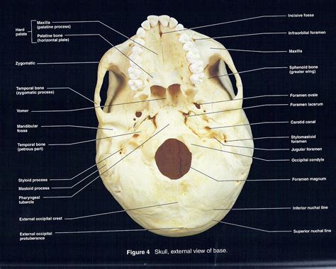 Inferior View of Skull