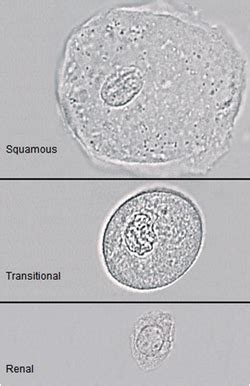 epithelial cells that can be found in urine | Medical Laboratories