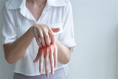 Fungal Skin Infections: Types, Treatment, and Prevention