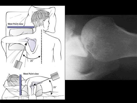 Shoulder Imaging - Shoulder & Elbow - Orthobullets