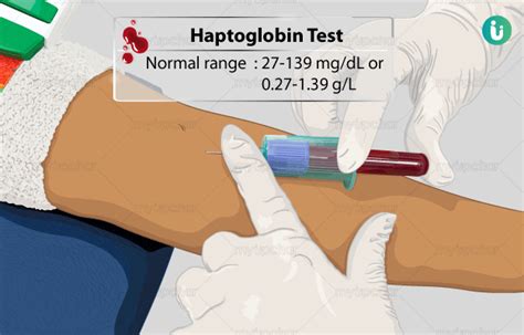 Haptoglobin Test: Procedure, Purpose, Results, Normal range, Cost ...