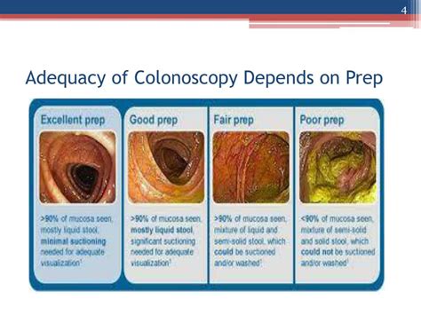 Colonoscopy Prep Poop Color Chart