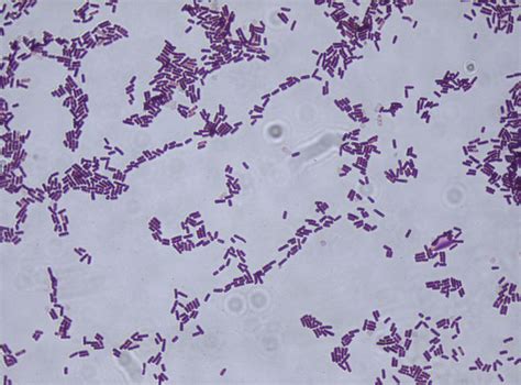 Bacillus subtilis gram stain | Bacillus subtilis, Bacillus, Microbiology