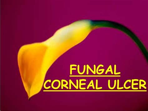 Fungal corneal ulcer