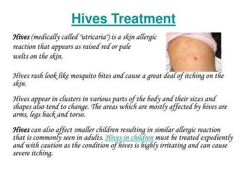 Autoimmune disorders that cause hives. Autoimmune Hives: Causes ...