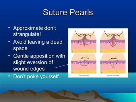 Introduction to suturing