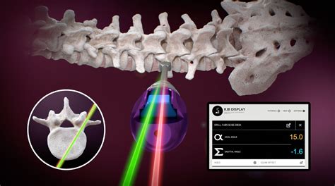 Vertebral Pedicles: Anatomy, Function, and Spine Surgery | Ruthless Spine