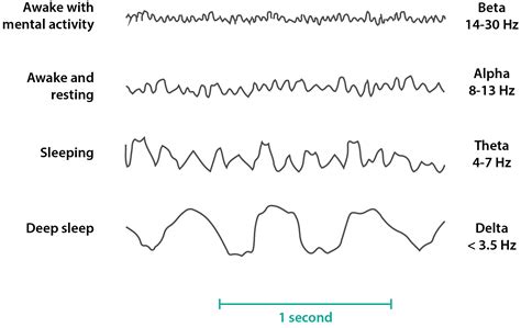 The Wave - The characteristics of an EEG — Firstclass