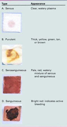 Stages of wound healing | The Paleo Mom | Health | Pinterest | Wound ...