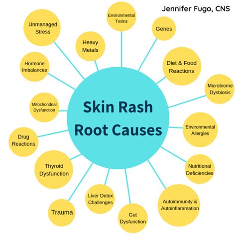 053: 16 Root Causes Driving Skin Rashes (Like Eczema, Psoriasis ...