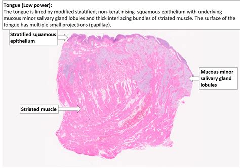 Tongue – Normal Histology – NUS Pathweb :: NUS Pathweb