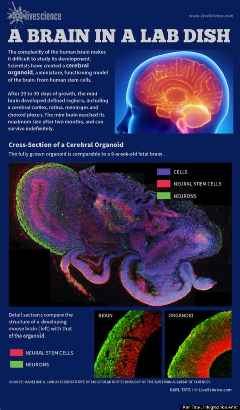 Human ‘Mini Brains’ Grown From Stem Cells In Lab Dish | We Wrestle Not ...