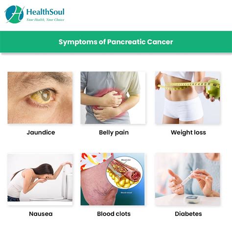 Pancreatic Cancer: Symptoms and Treatment – Healthsoul