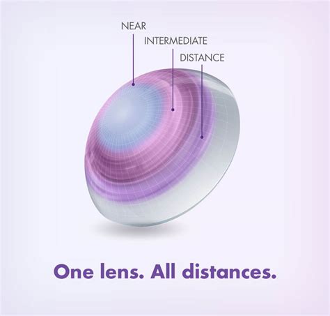 Contact Lenses - Contact Fitting - EYE PHILOSOPHY OPTOMETRISTS