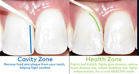 How to Maximize the Benefits of Flossing