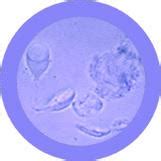 Giardia (Giardia lamblia)