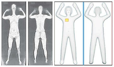 TSA dumping airport X-ray body scanners - SFGate