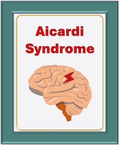 11 Aicardi Syndrome Images, Stock Photos, 3D objects, & Vectors ...