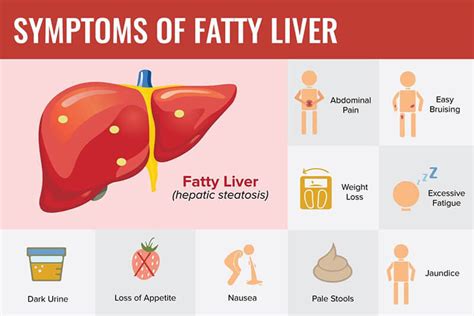 How Nash and fatty liver effects daily functioning of the liver