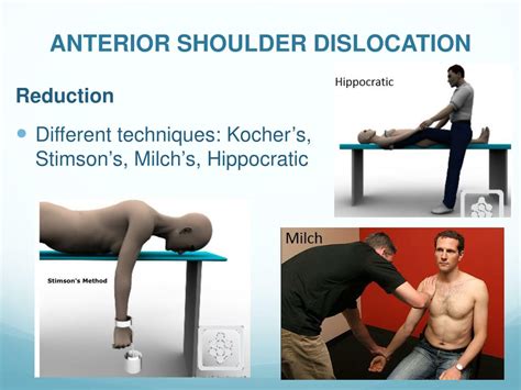 Anterior Shoulder Dislocation Reduction