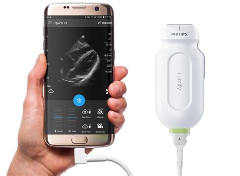 The mobile ultrasound revolution: How technology is expanding this ...