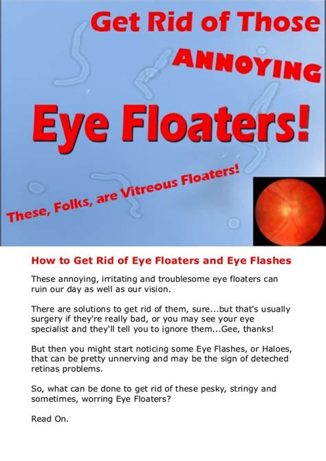 Get Rid Of Eye Floaters and Eye Flashes Naturally