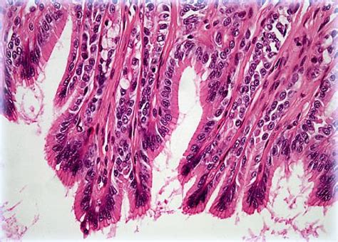 Simple Columnar Epithelium | Olympus LS