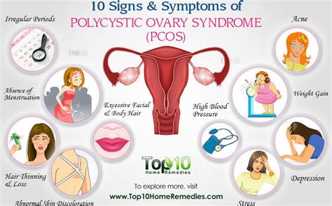 Understanding Polycystic Ovarian Syndrome | The Herald