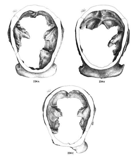 Homo erectus skull cross-section - PICRYL - Public Domain Media Search ...