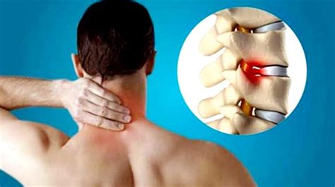 Cervical Spondylosis: What are its Symptoms & Treatment? – Arun Bhanot