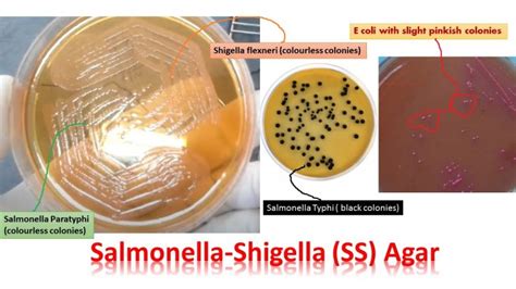 Salmonella-Shigella (SS) Agar: Introduction, Composition, Principle, Pro