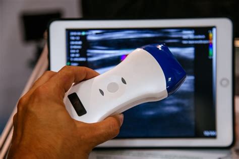 How Mobile Ultrasounds Advance the Medical Industry | National Ultrasound