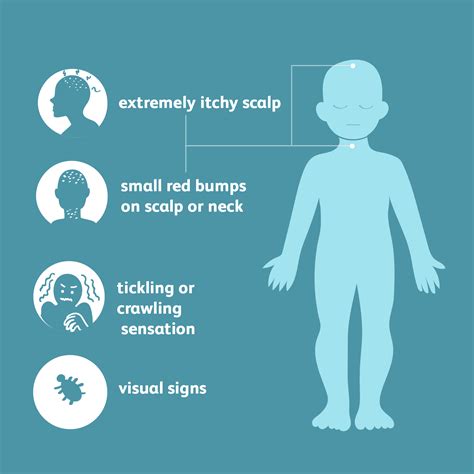 Summa Health: What Happens If Lice Goes Untreated